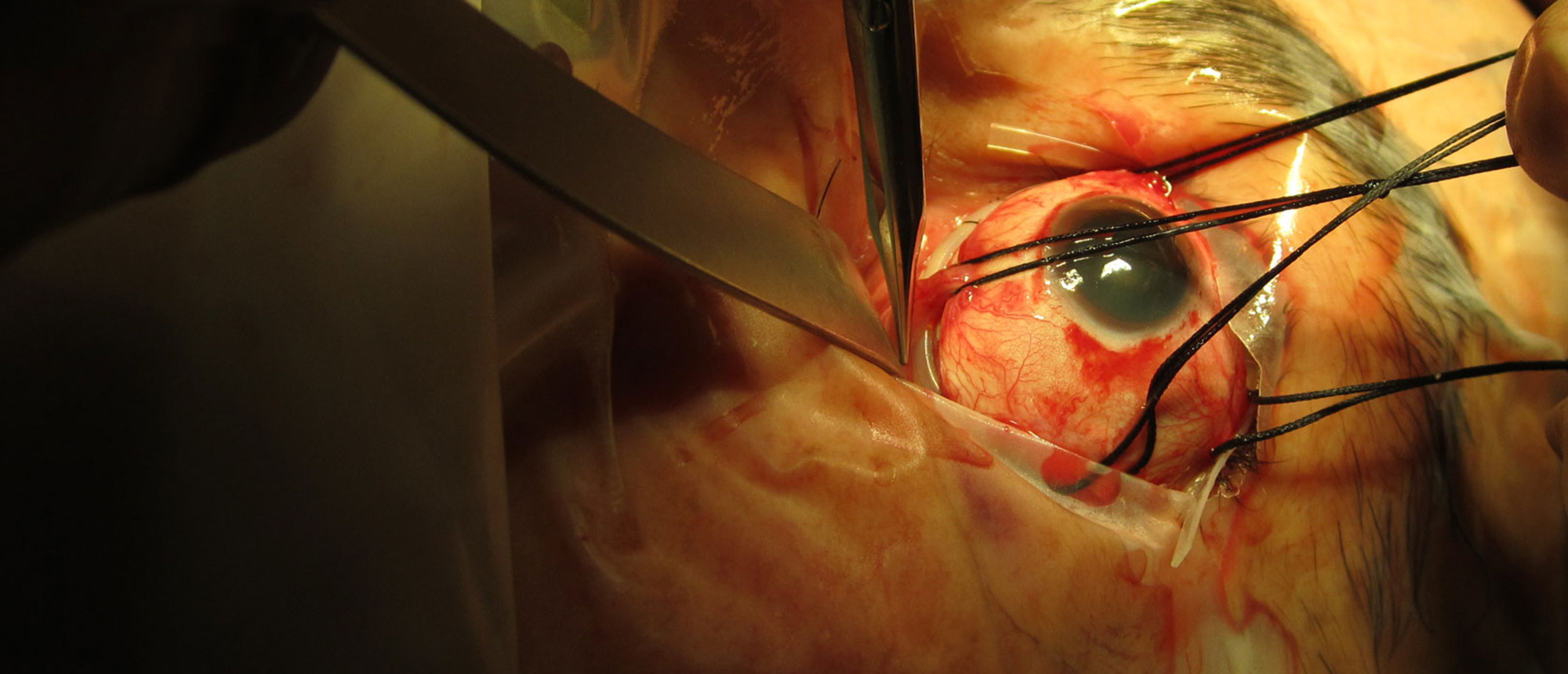 Vitreoretinal Surgery Online Textbook