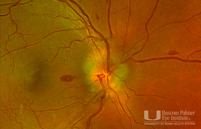 Roth Spot Image 1