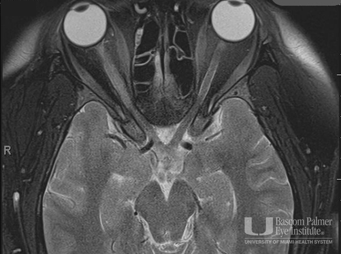 MRI Image 1 