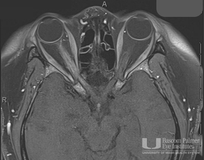 MRI Image 2