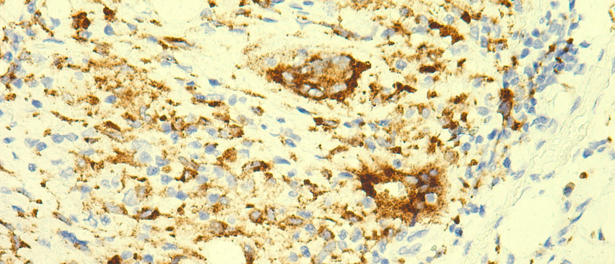 Ophthalmic Pathology