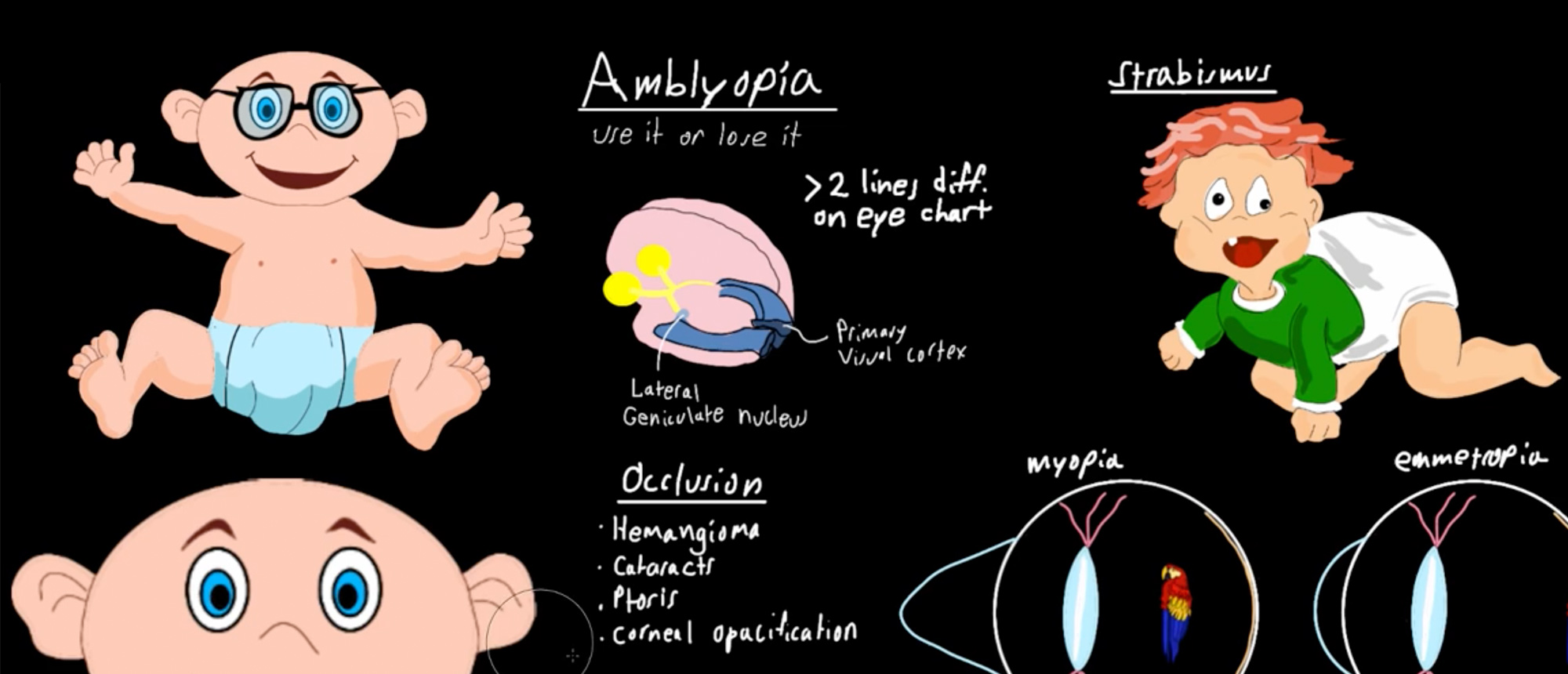 Pediatric Ophthalmology